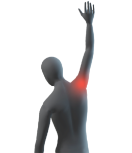 Last van schouderpijn